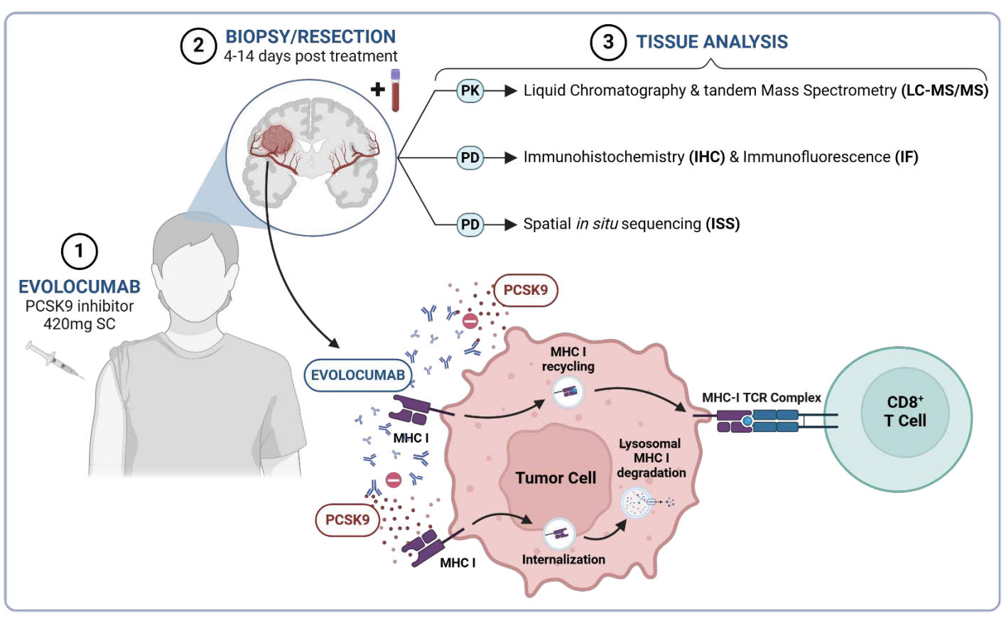 A surgical window of opportunity trial evaluating the effect of the PCSK9 inhibitor evolocumab on tumoral MHC-I expression and CD8+ infiltration in glioma (PREPRINT)